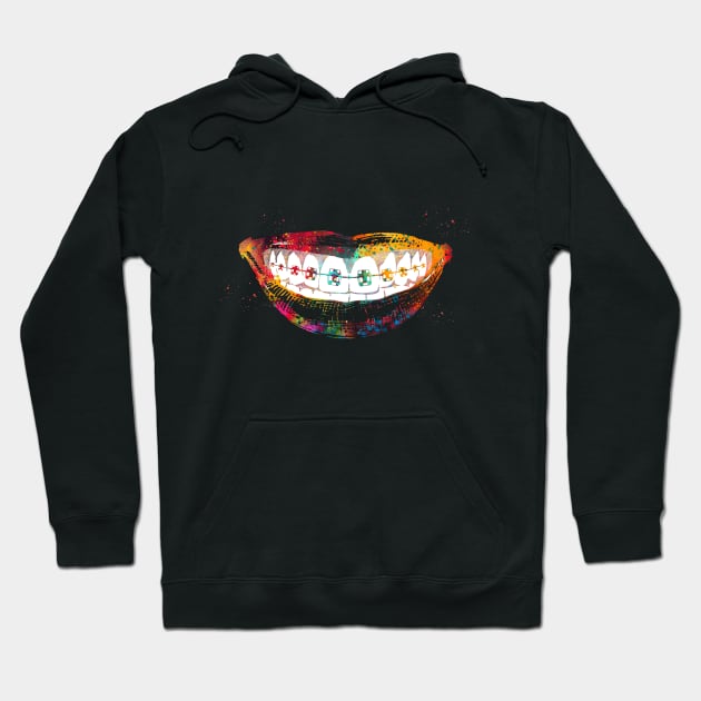 Teeth braces Hoodie by erzebeth